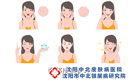 攝圖網_401796398_面部皮膚問題護理（企業商用）