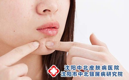 攝圖網_501744732_被敏感肌困惱的年輕女性（企業商用）