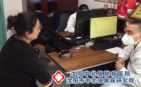 沈陽銀屑病的治療-沈陽治療牛皮癬醫院