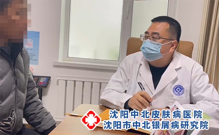 沈陽銀屑病好醫院-沈陽牛皮癬專治醫院