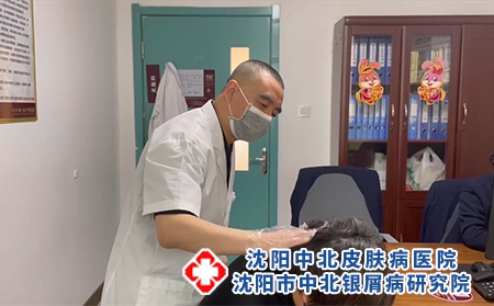 沈陽牛皮癬?？浦委熱t院在哪-沈陽有哪些醫院看銀屑病正規