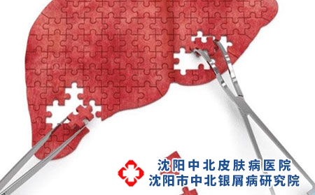 2 (123)肝腎