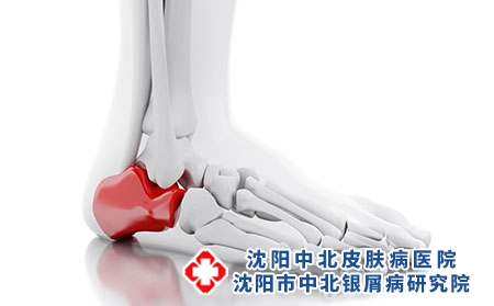 攝圖網_303363041_3d說明白色背景上疼痛的腳踝醫學概念（企業商用）