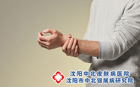 攝圖網(wǎng)_501528683_青年男性手腕疼痛（企業(yè)商用）關(guān)節(jié)