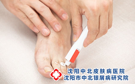 攝圖網_501661624_腳部涂抹藥膏（企業商用）