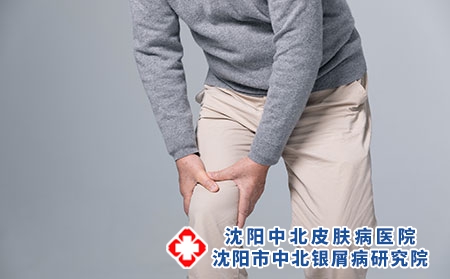 攝圖網(wǎng)_501703651_受傷的老年人膝蓋疼痛（企業(yè)商用）關(guān)節(jié)