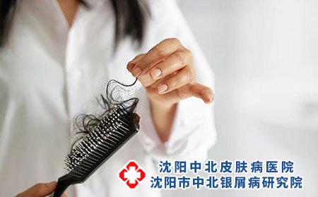 2 (35)頭發