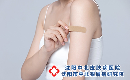 攝圖網_501700725_胳膊受傷貼創可貼的女性（企業商用）
