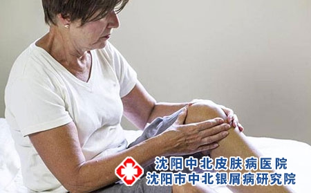 2 (179)關節