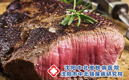3 (148)飲食