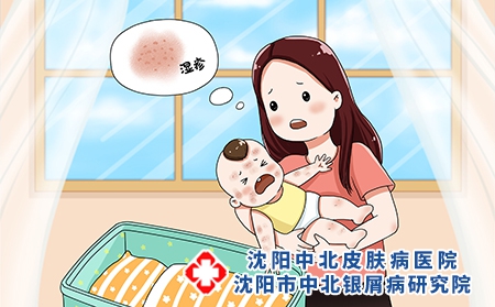 攝圖網(wǎng)_401767228_嬰兒濕疹（企業(yè)商用）