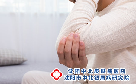 攝圖網_500708291_生病的年輕人胳膊疼（企業商用）關節