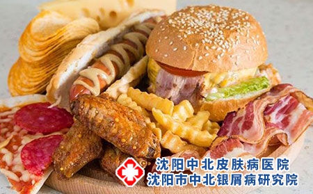 2 (285)油炸飲食