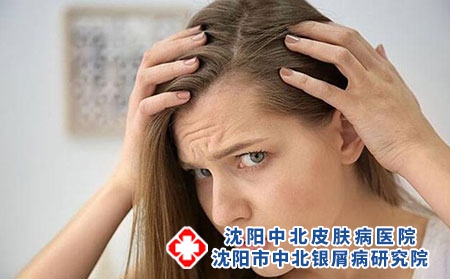 2 (233)頭發