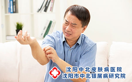 攝圖網_501661567_中年人男性手臂皮膚瘙癢（企業商用）