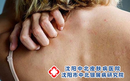 癥狀 (2)