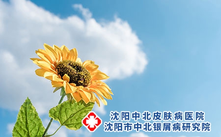 攝圖網(wǎng)_500530563_陽(yáng)光下的向日葵（企業(yè)商用）
