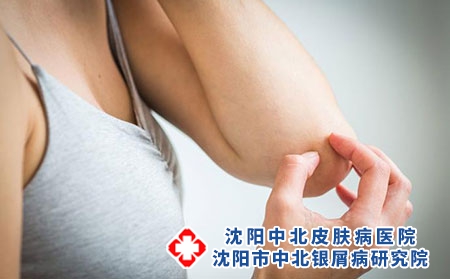 癥狀