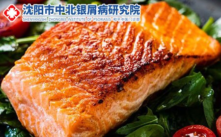 牛皮癬病人可以吃魚嗎