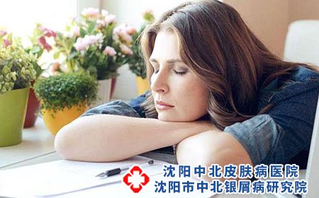 銀屑病發病原因