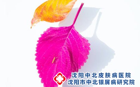 銀屑病患者可以吃葡萄嗎
