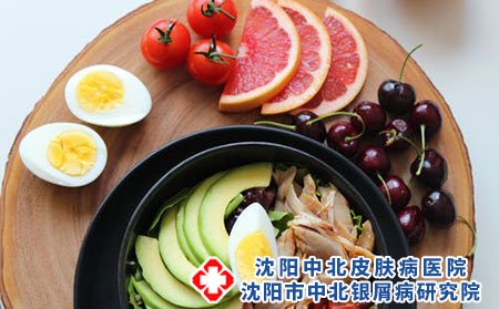 牛皮癬患者可以吃什么呢?