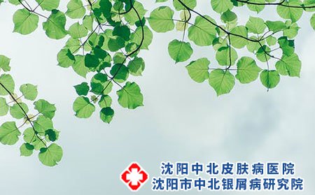 沈陽中北銀屑病研究院費用合理嗎