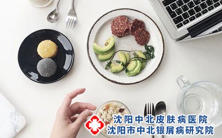 頭部銀屑病可以通過飲食調整改善病情嗎?