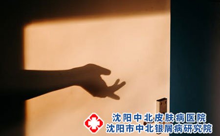 上班族容易產生銀屑病的因素分析