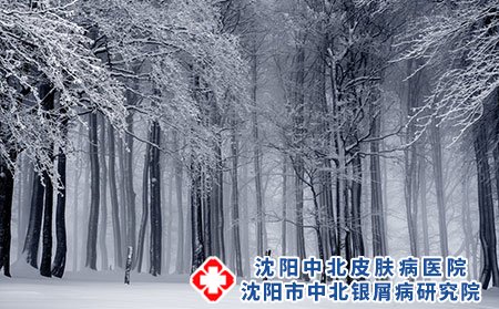 沈陽銀屑病的醫院網上評價怎么樣?