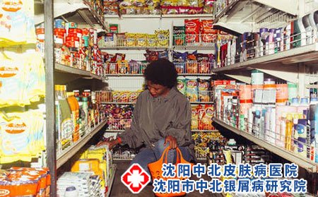 沈陽銀屑病醫院治療推薦中北