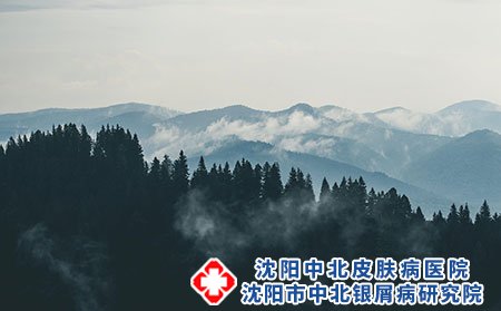 沈陽(yáng)中北銀屑病醫(yī)院：銀屑病真的很難治療嗎