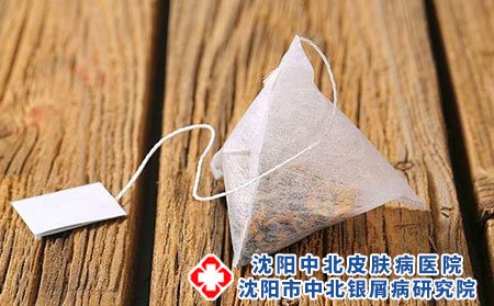 沈陽中北銀屑病醫院講得了銀屑病有哪些危害